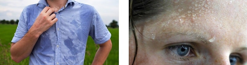 Man and woman suffering from excessive sweating